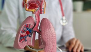 Paridiprubart от Edesa Biotech значительно снижает смертность при ARDS