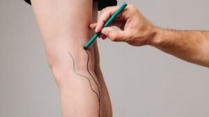 Okami Medical привлекает $45 млн для развития сосудистых технологий и расширения рынка